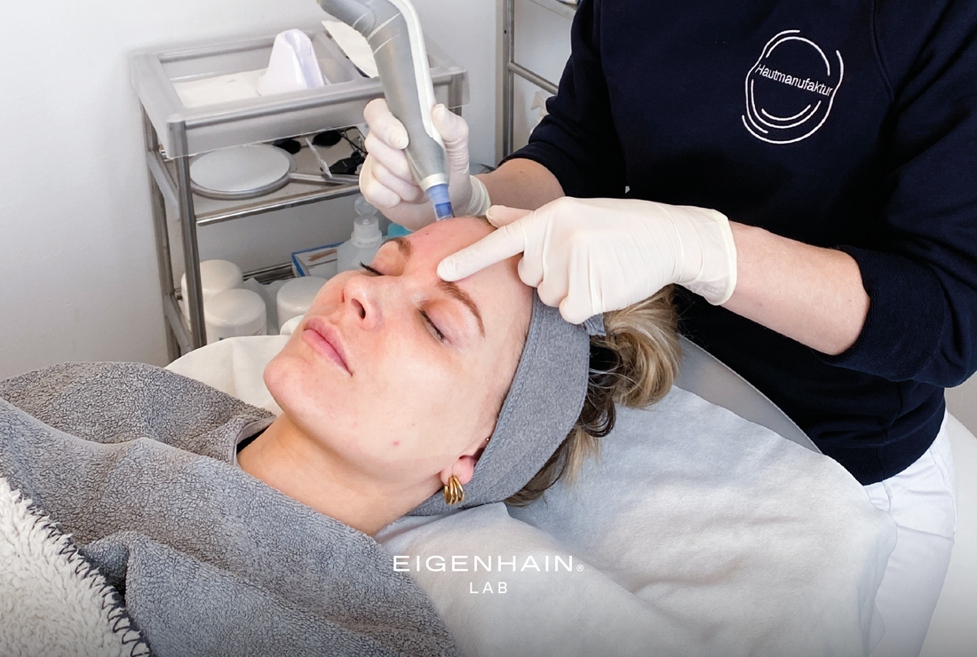 Do's and Don'ts beim Microneedling
