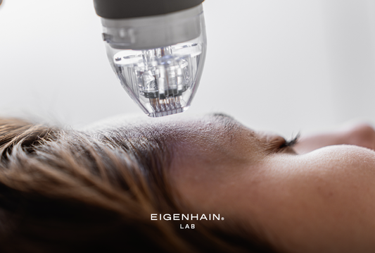 Narben, Falten, Pigmentflecken mit Microneedling behandeln: Worauf ist zu achten?