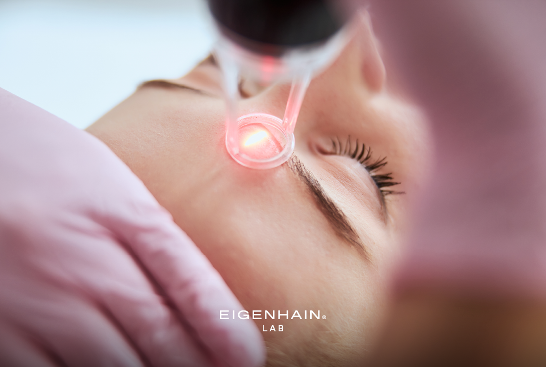 Rötungen, Schwellungen und Pigmentstörungen nach der Laserbehandlung